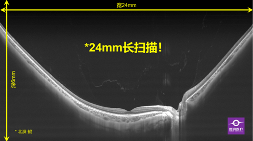 小黄飞最新作品,《小黄飞》新力作惊艳亮相。